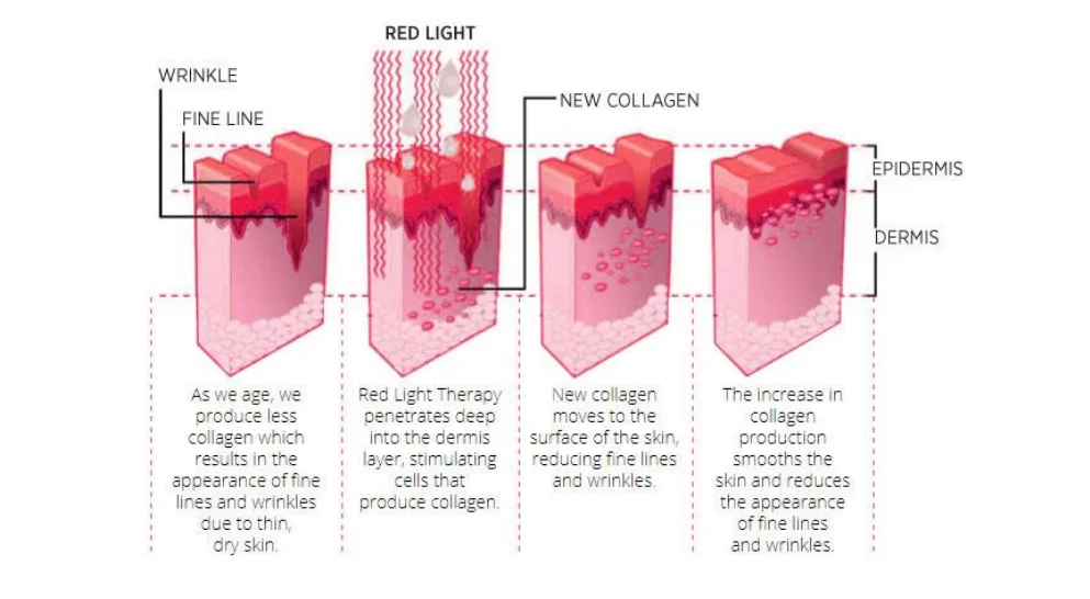China PDT Therapy Beauty Equipment001