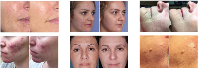 Professional LED Light Therapy Machines 7 Professional LED Light Therapy Machines004