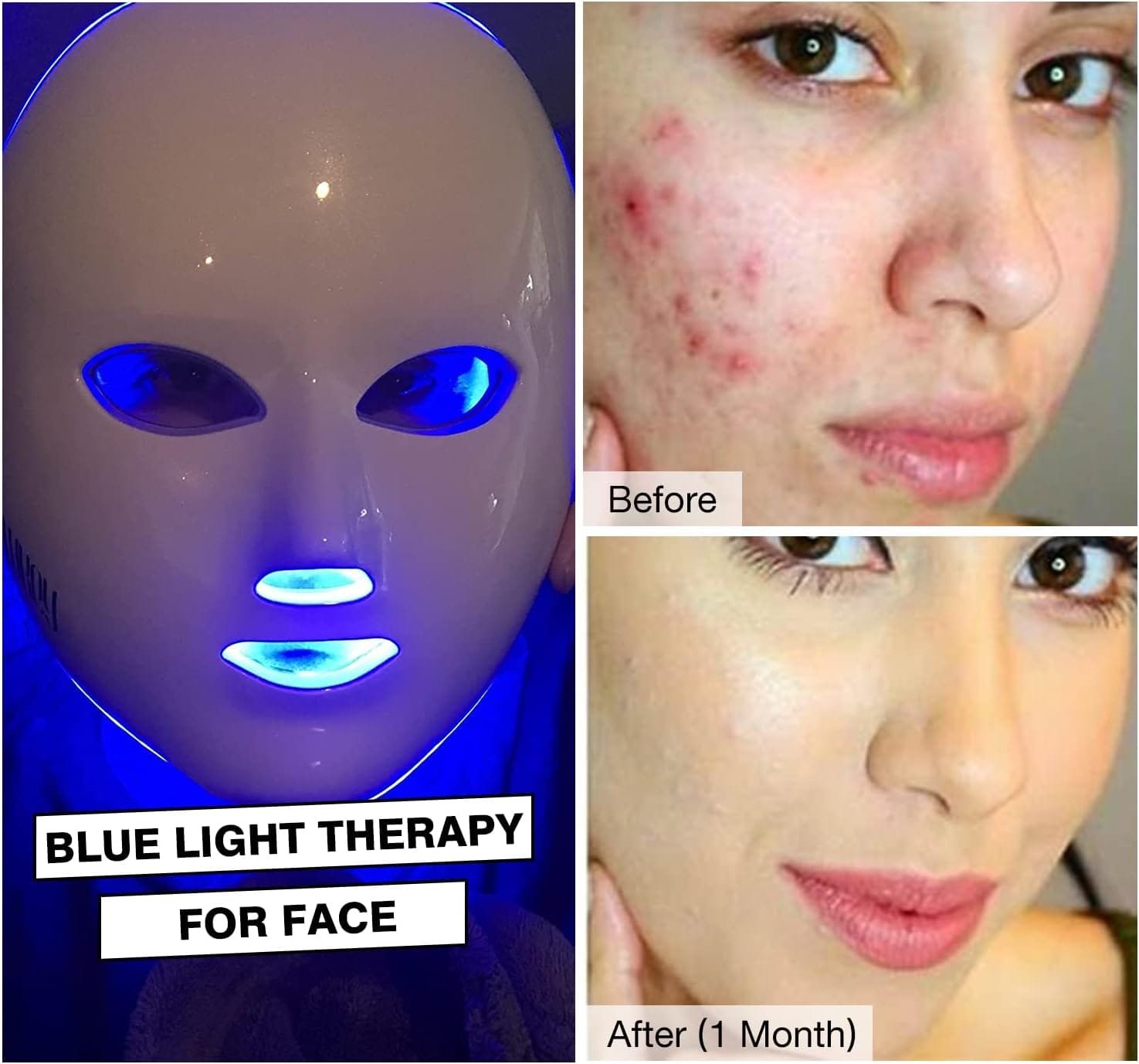 Photodynamic Therapy Before and After: A Guide by MAIKONG CO.LTD