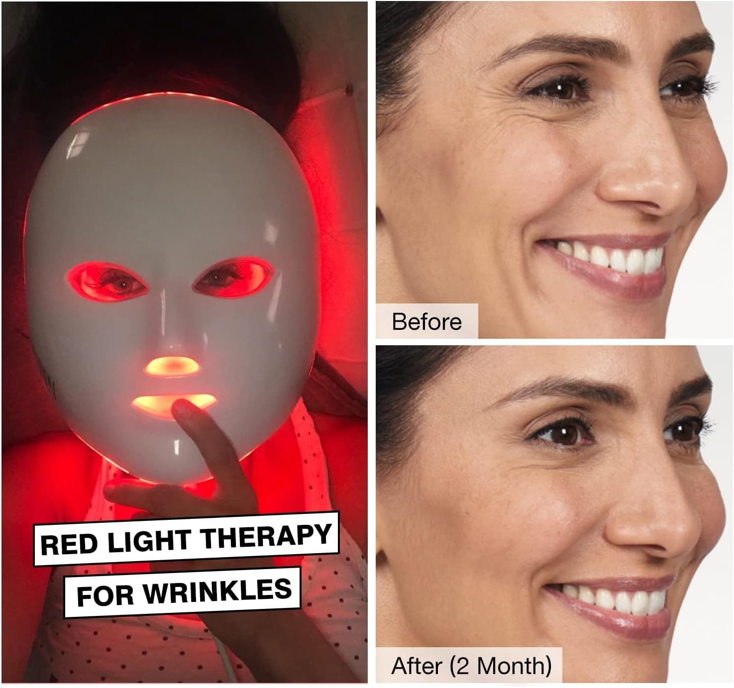 blue light therapy before and after
